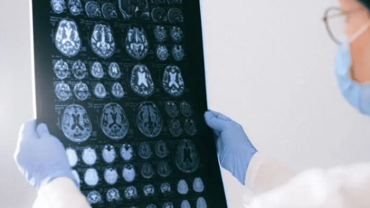 Foto - 11 yıl kanser tedavisi gördü: Doktoru emekli olunca hayatının şokunu yaşadı!