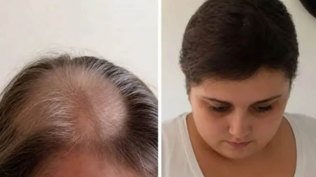 Foto - 11 yıl kanser tedavisi gördü: Doktoru emekli olunca hayatının şokunu yaşadı!