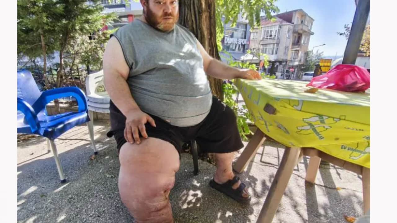 Foto - 4 yıldır bu çileyi çekiyor! Kurtulmak için tek çaresi var!