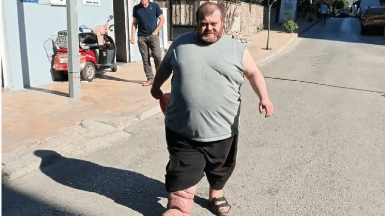 Foto - 4 yıldır bu çileyi çekiyor! Kurtulmak için tek çaresi var!