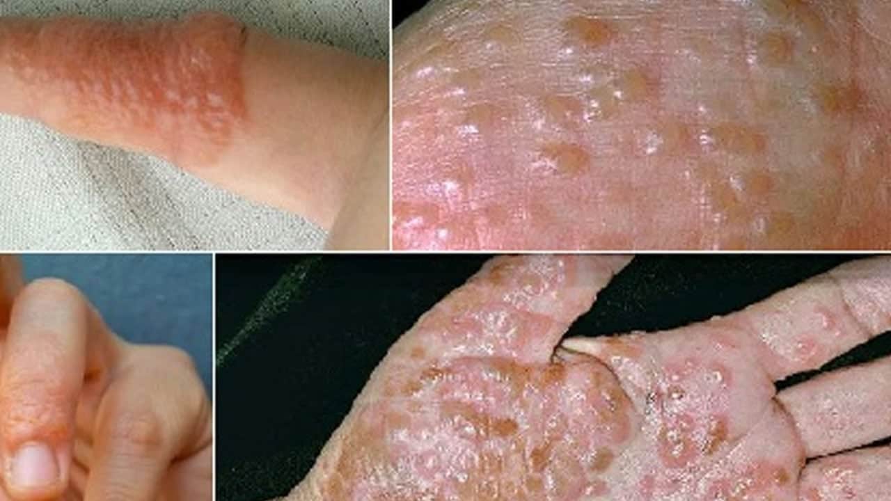  40 yaşı geçenler kesin kullanmalı! Sebebi: Egzamadan koruyor! Cilt yaşlanmasını geciktiren en güçlü 3 sabun