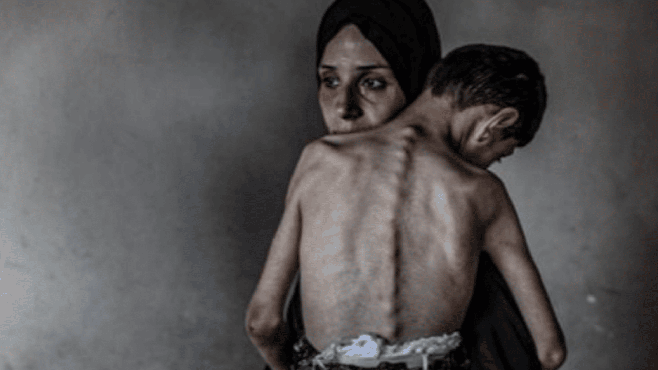 Foto - 72 binden fazla Filistinli şehid oldu... İsrail ablukası sürüyor: Gazze’de kıtlık artıyor