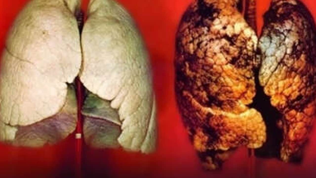Foto - Akciğerleri tertemiz yapıyor: Sigara içenlere öneri! Ciğerlerinizdeki kirli o alanı açıyor... Öyle bir malzeme ki