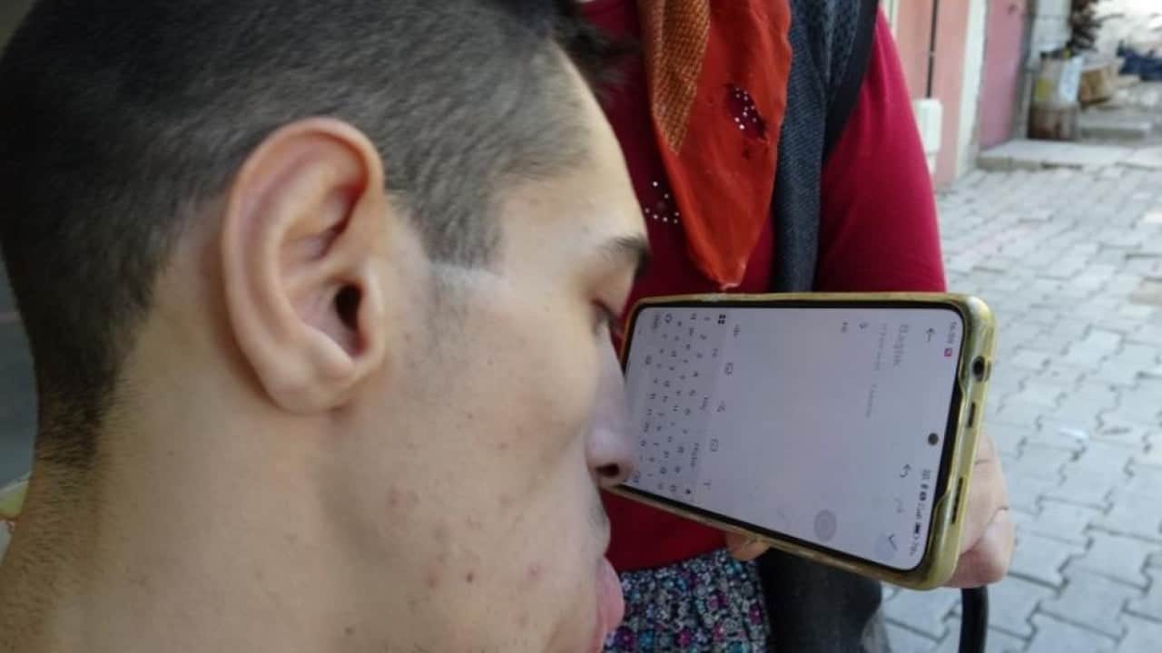 Azmiyle herkese örnek oldu! Telefonunu burnuyla kullanıyor