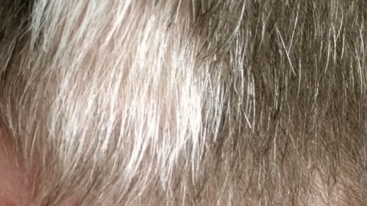 Foto - Uzmanlar cilt sistemi hakkında öyle şeyler açıkladılar ki.... Şok olacaksınız