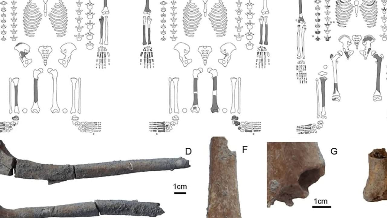 Foto - Binlerce yıllık... Tarihin sıfır noktası olan Göbeklitepe'de biri kadın iki kişinin insan mezarları bulundu
