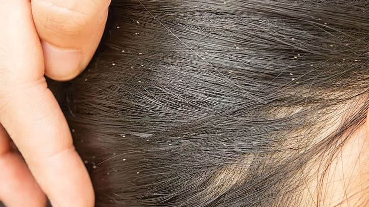 Foto - Bu hatayı sakın yapmayın... Uzmanından kritik uyarı: Bit temizliği çocuklarda korku yapıyor diyor... Büyük yanlışlık 