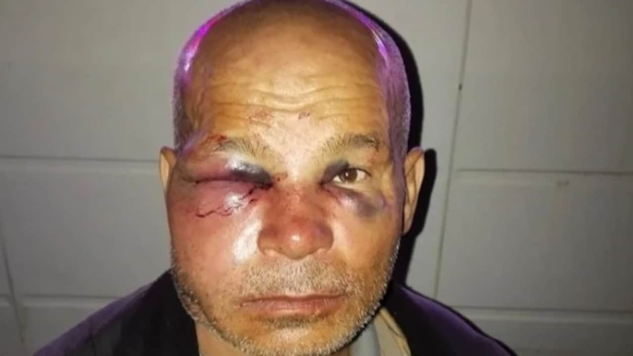 Bunu yapan insan olamaz: Sağır ve dilsiz adamı öldüresiye dövdüler!
