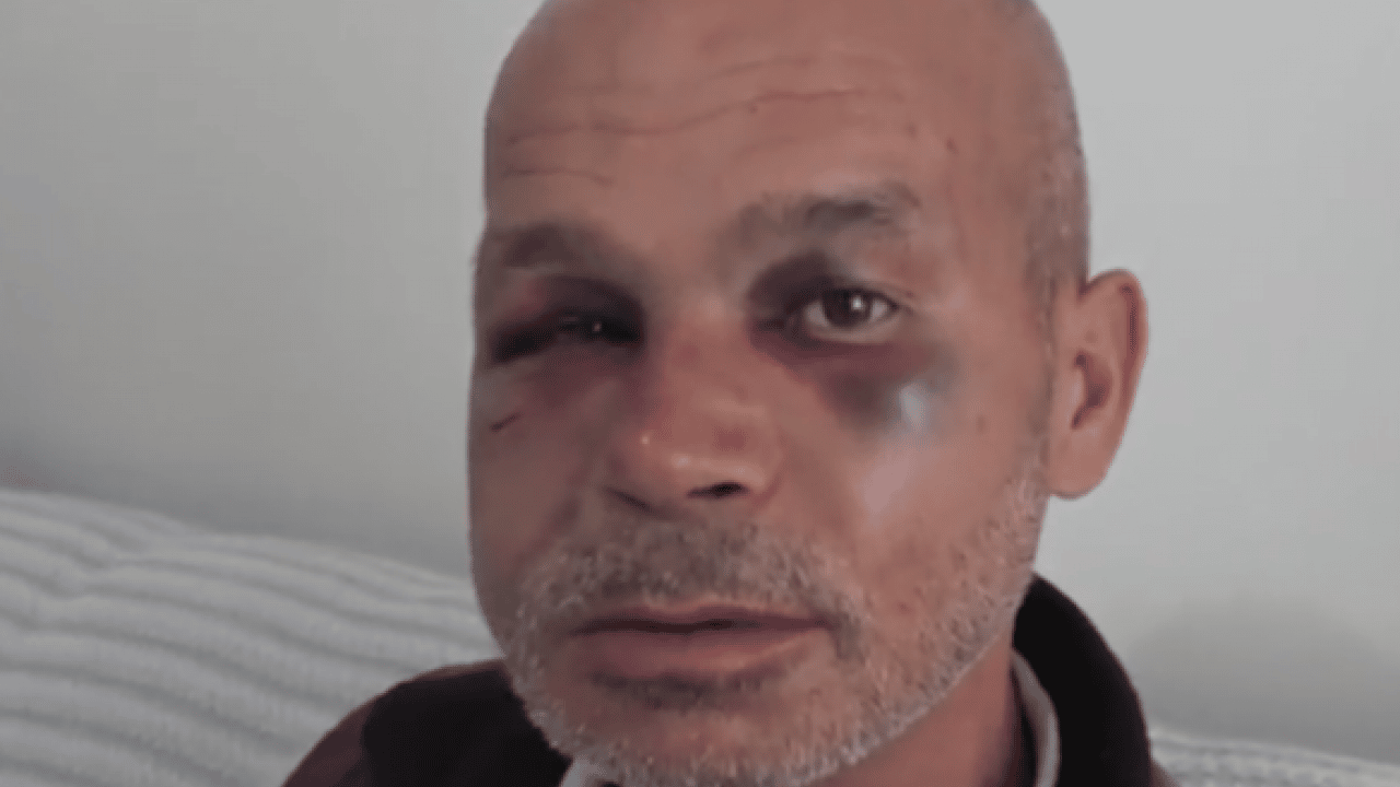 Foto - Bunu yapan insan olamaz: Sağır ve dilsiz adamı öldüresiye dövdüler!