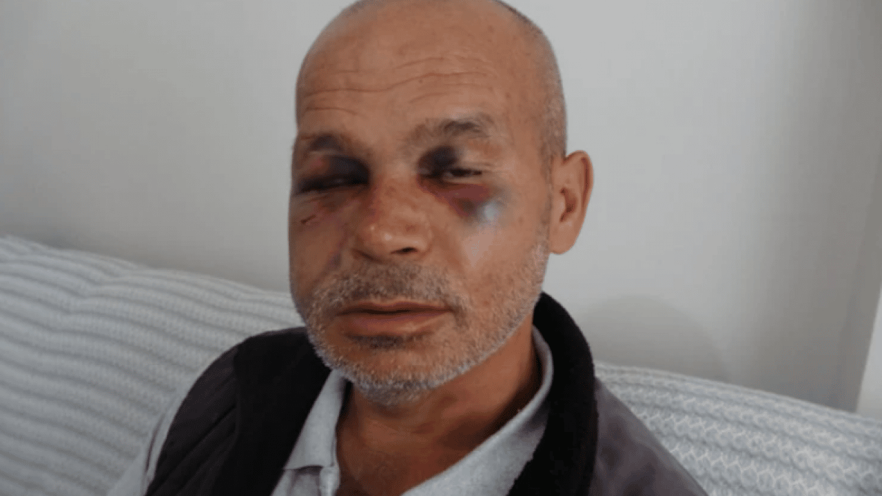 Foto - Bunu yapan insan olamaz: Sağır ve dilsiz adamı öldüresiye dövdüler!
