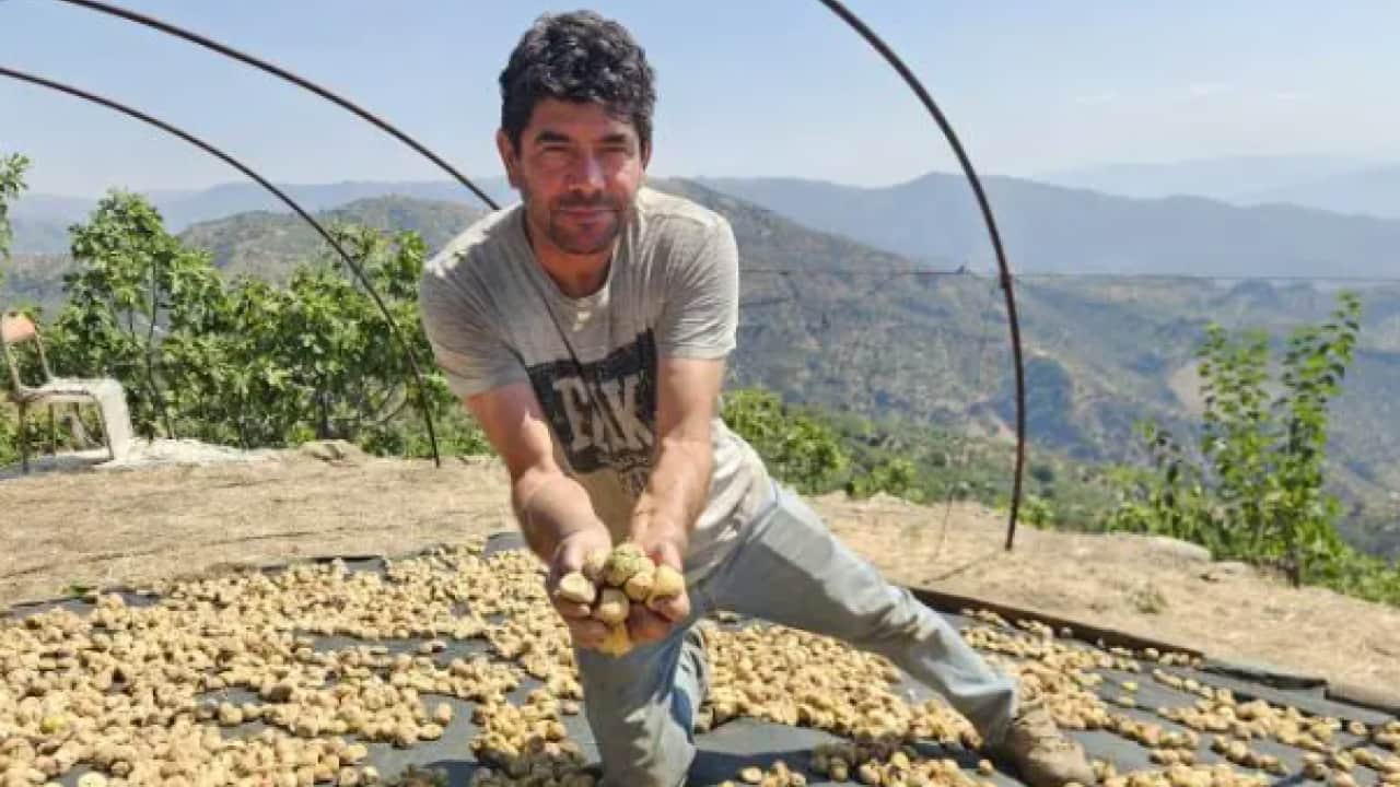 Foto - Çift kol nakli olmuştu! Aldığı haberle dünyası karardı!