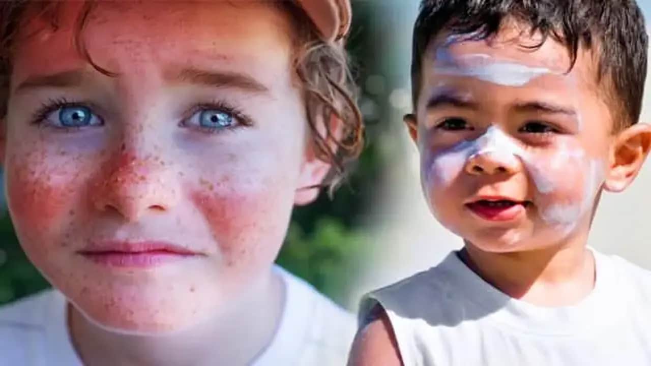 Foto - Cilt ve deri kanseri bile oluyor: Kendileri bize başvuruyor diyen uzmanı saç ve parmak arasına bakın diyor