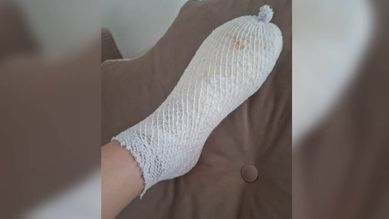 Foto - Çocuğunuza oyuncak alırken dikkat! Patlayan stres oyuncağı için suç duyurusu