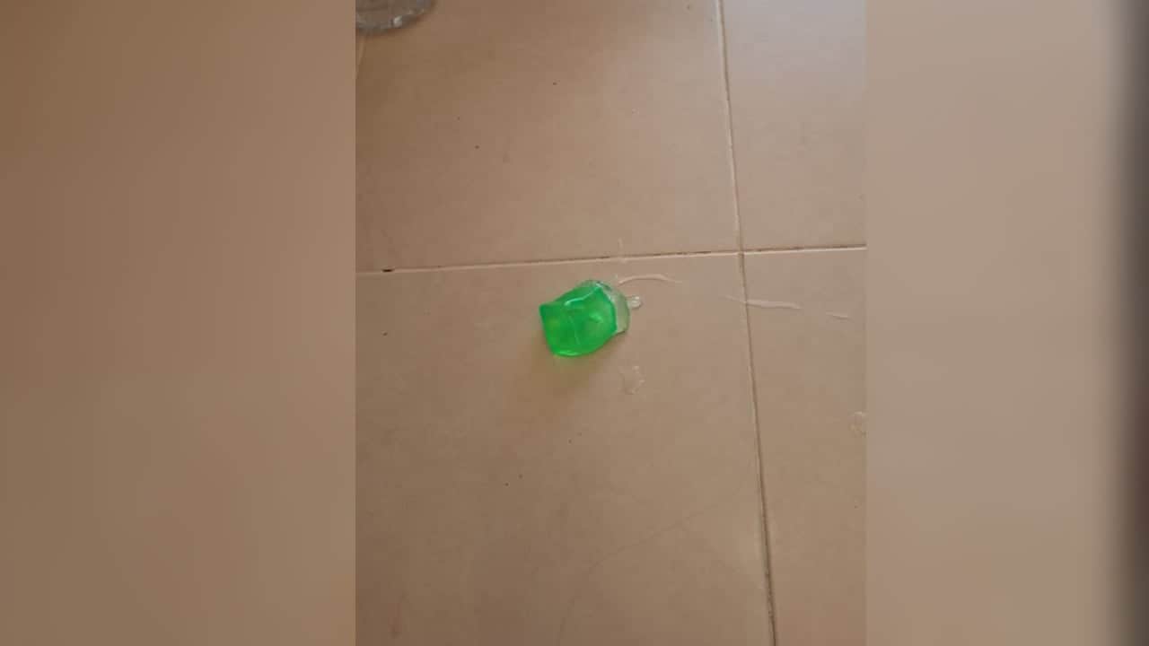Foto - Çocuğunuza oyuncak alırken dikkat! Patlayan stres oyuncağı için suç duyurusu