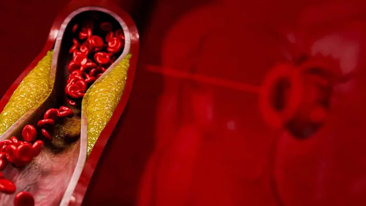 Doğrudan içen yandı! Her evde var: O içecek damarları tıkıyor! Masum değil sağlık riski var, uyarı verildi