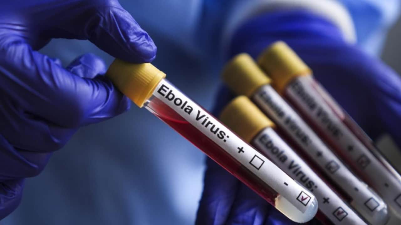 Foto - DSÖ doğruladı: Uganda’da Ebola salgını sona erdi, KDC’de alarm sürüyor