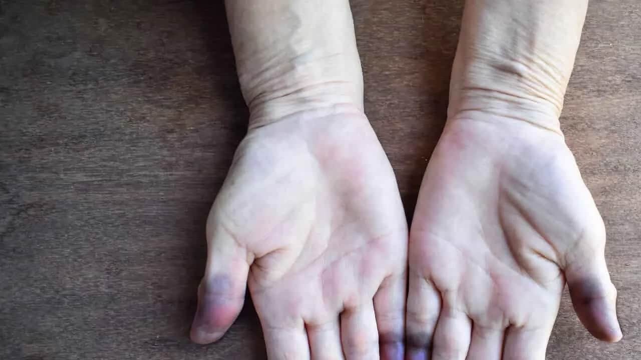 Foto - El ve ayakları beyazlatan yöntemler yardımcı oluyor sürün: Bölgeye uygulayın! Onlarla banyo yapın