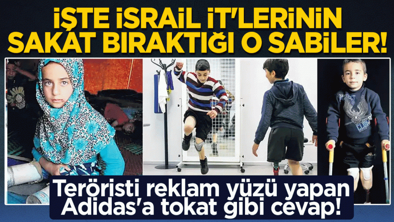 Eli kanlı teröristi reklam yüzü yapan Adidas'a tokat gibi cevap! İşte İsrail İt’lerinin sakat bıraktığı o sabiler