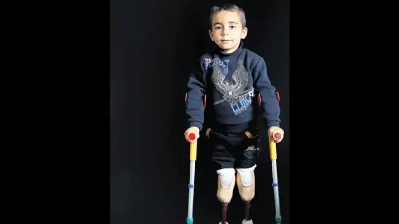 Foto - Eli kanlı teröristi reklam yüzü yapan Adidas'a tokat gibi cevap! İşte İsrail İt’lerinin sakat bıraktığı o sabiler