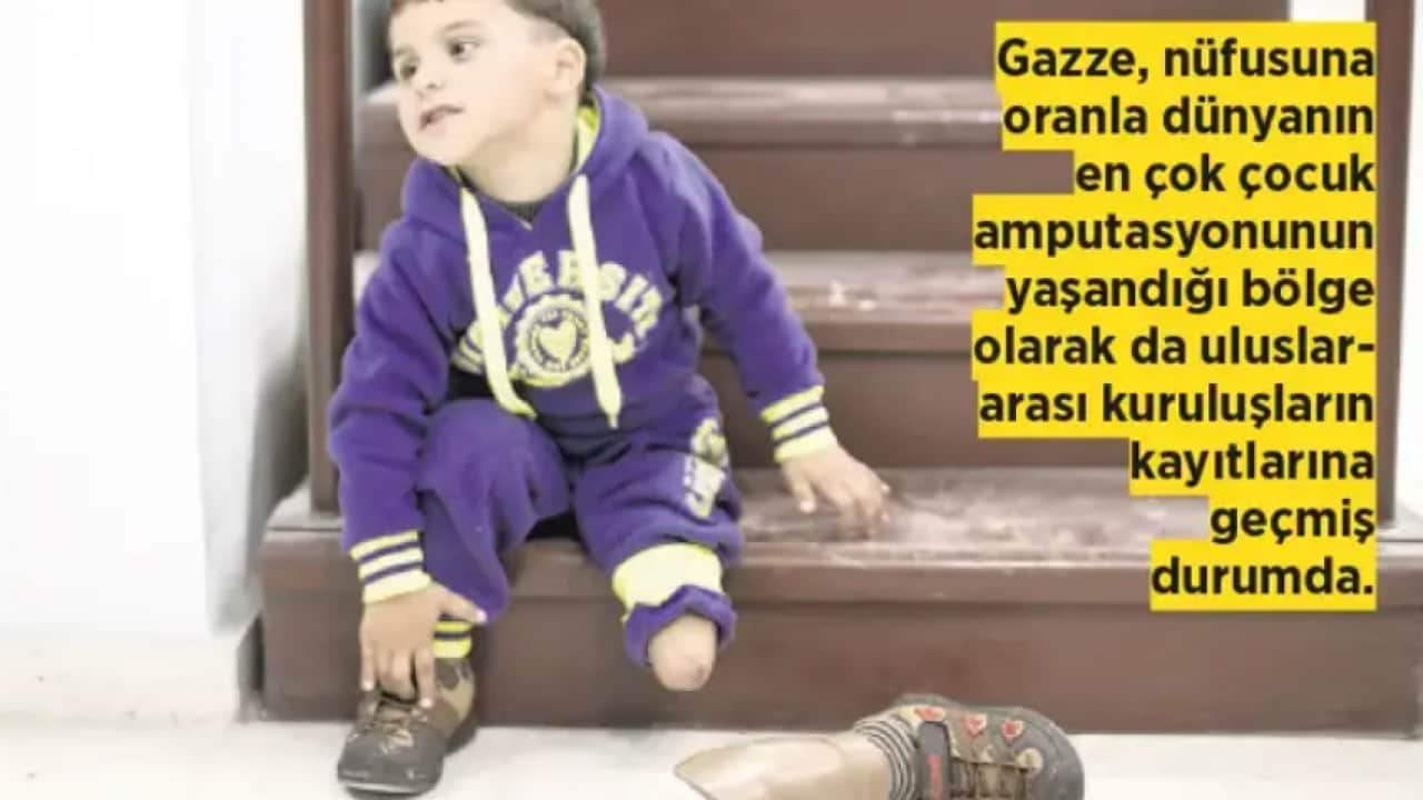 Foto - Eli kanlı teröristi reklam yüzü yapan Adidas'a tokat gibi cevap! İşte İsrail İt’lerinin sakat bıraktığı o sabiler