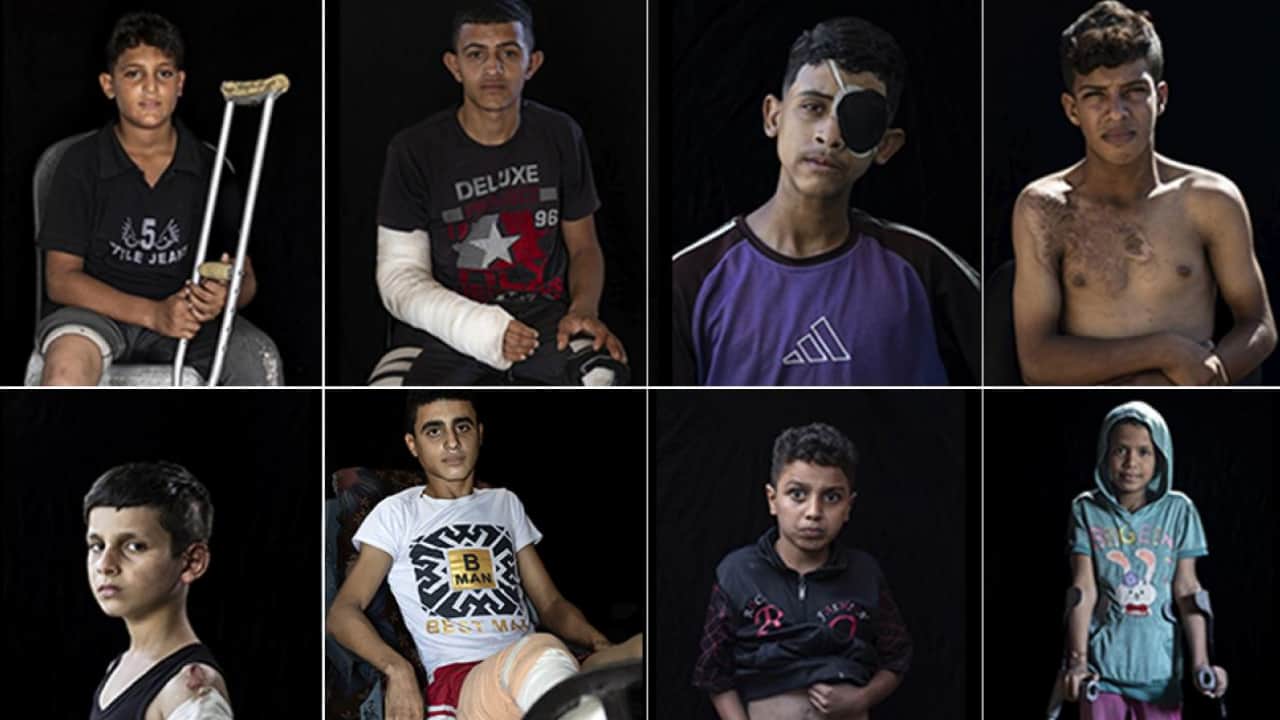 Foto - Eli kanlı teröristi reklam yüzü yapan Adidas'a tokat gibi cevap! İşte İsrail İt’lerinin sakat bıraktığı o sabiler