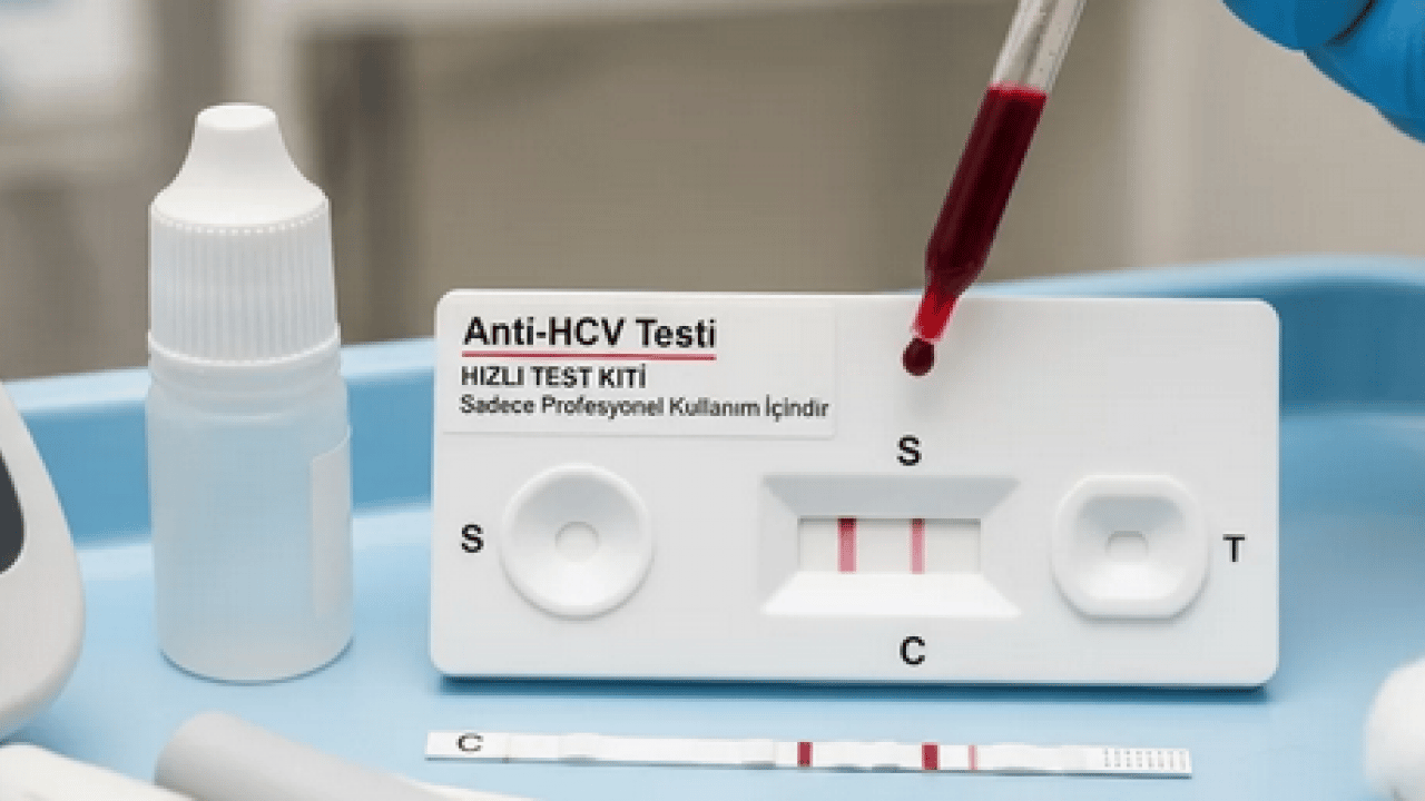 Foto - Erken tanı ve tedavi hayat kurtarıyor: Hepatit B ve C testinizi sakın ihmal etmeyin!