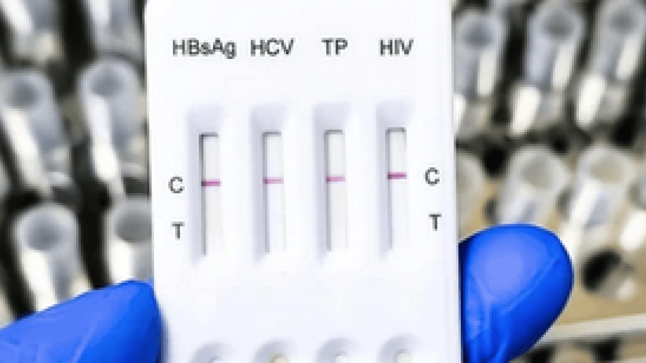 Foto - Erken tanı ve tedavi hayat kurtarıyor: Hepatit B ve C testinizi sakın ihmal etmeyin!