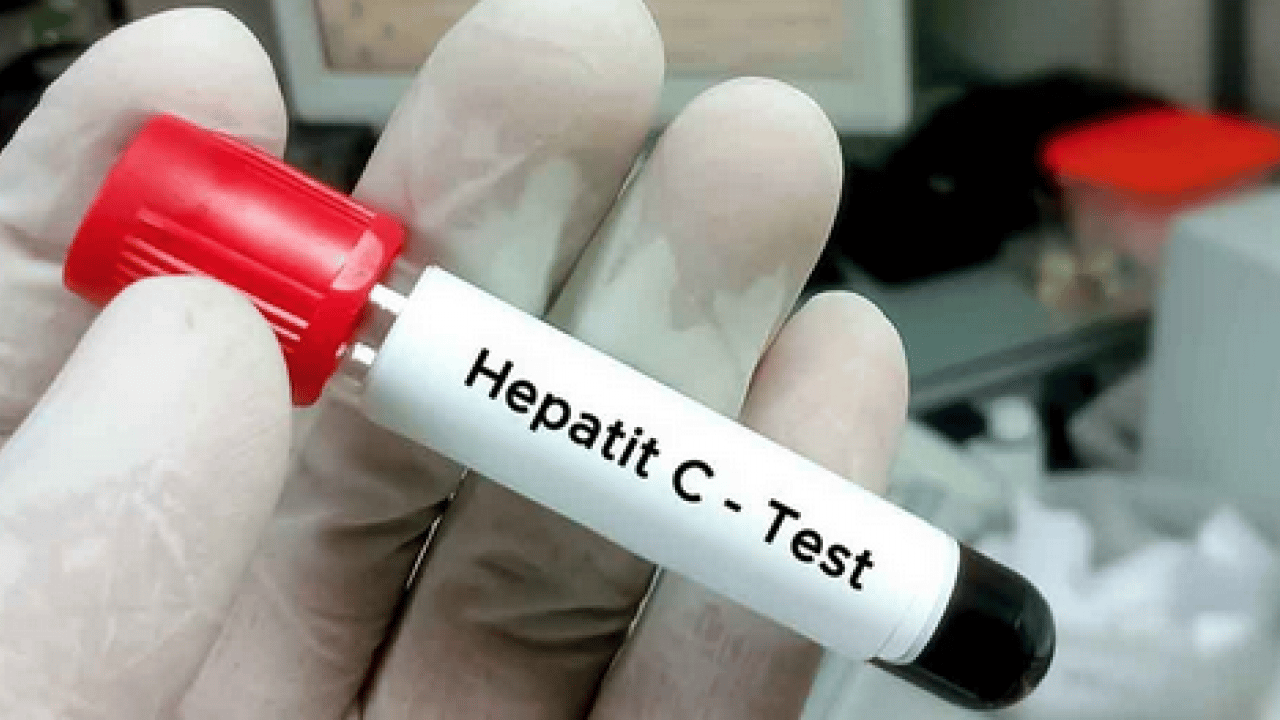 Foto - Erken tanı ve tedavi hayat kurtarıyor: Hepatit B ve C testinizi sakın ihmal etmeyin!