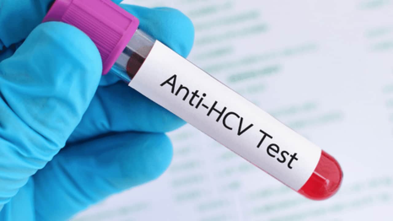 Erken tanı ve tedavi hayat kurtarıyor: Hepatit B ve C testinizi sakın ihmal etmeyin!