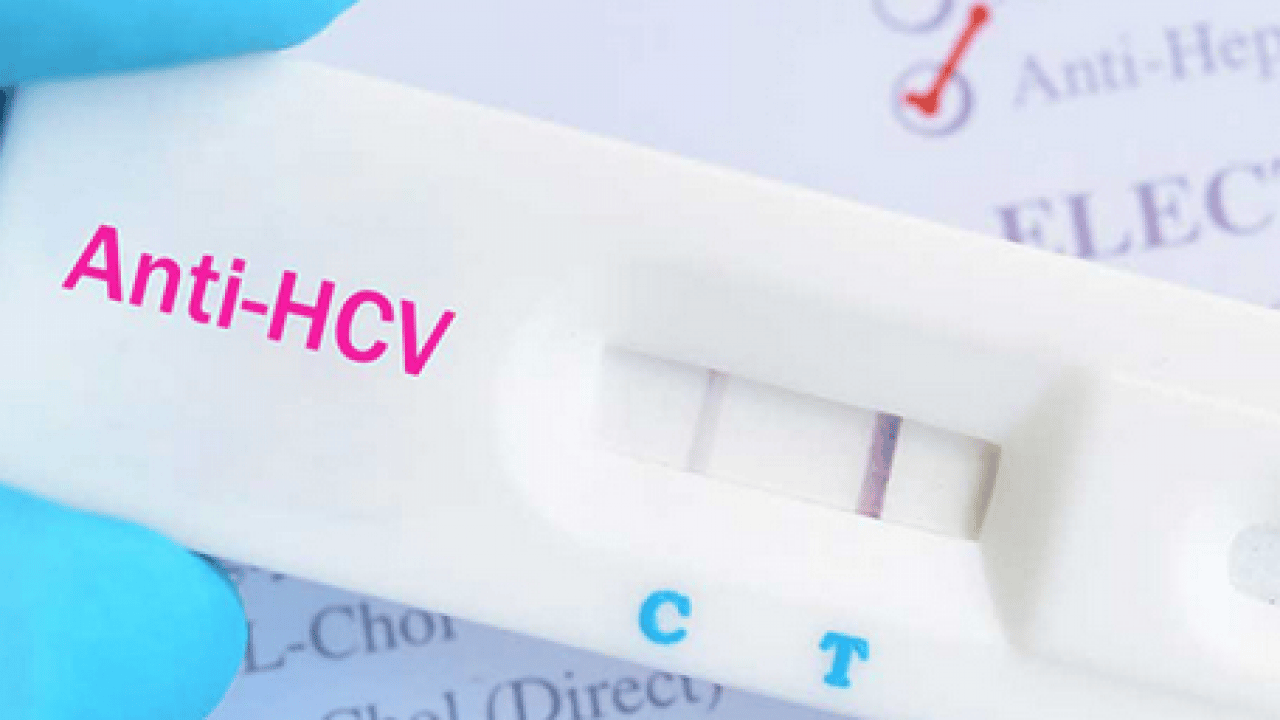 Foto - Erken tanı ve tedavi hayat kurtarıyor: Hepatit B ve C testinizi sakın ihmal etmeyin!