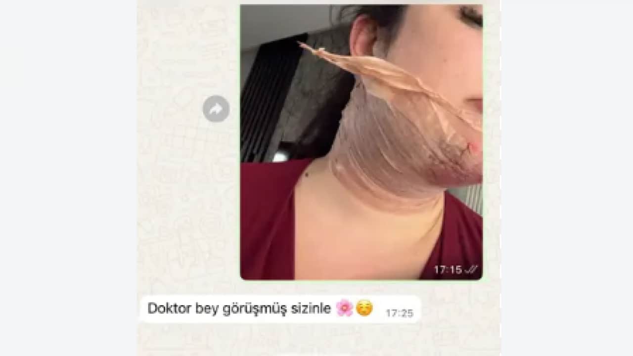 Foto - Estetik merakı hayatları tehdit ediyor: Güzelleşmek isterken canından oluyordu