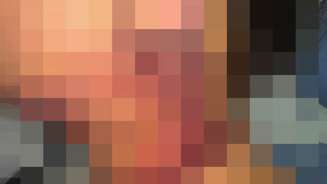 Foto - Estetik merakı hayatları tehdit ediyor: Güzelleşmek isterken canından oluyordu