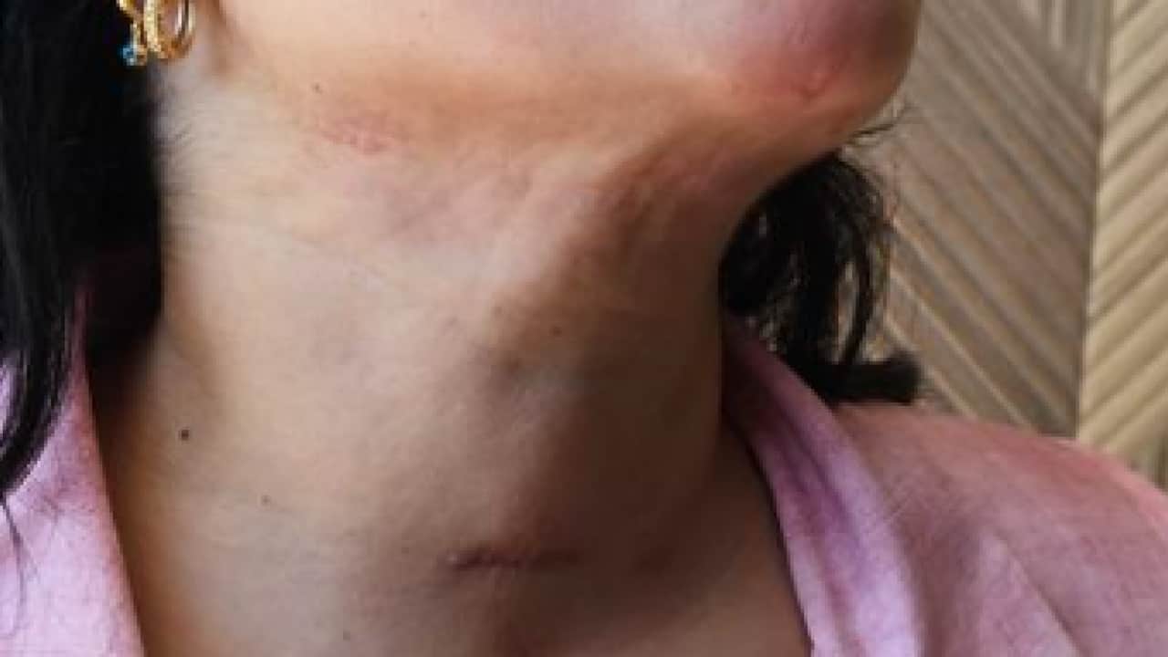 Foto - Estetik merakı hayatları tehdit ediyor: Güzelleşmek isterken canından oluyordu
