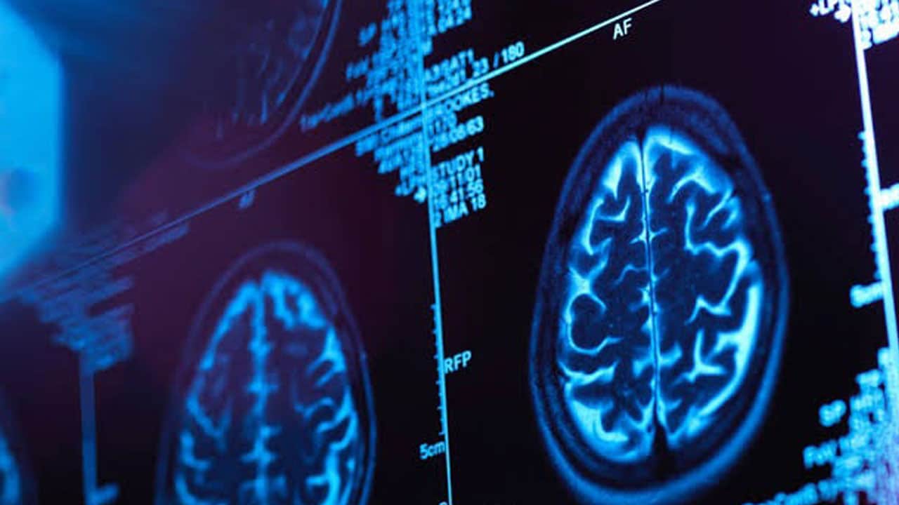 Foto - Fark edilmiyor sinsi ilerliyor! Alzheimer belirtisi uykuda mı başlıyor?
