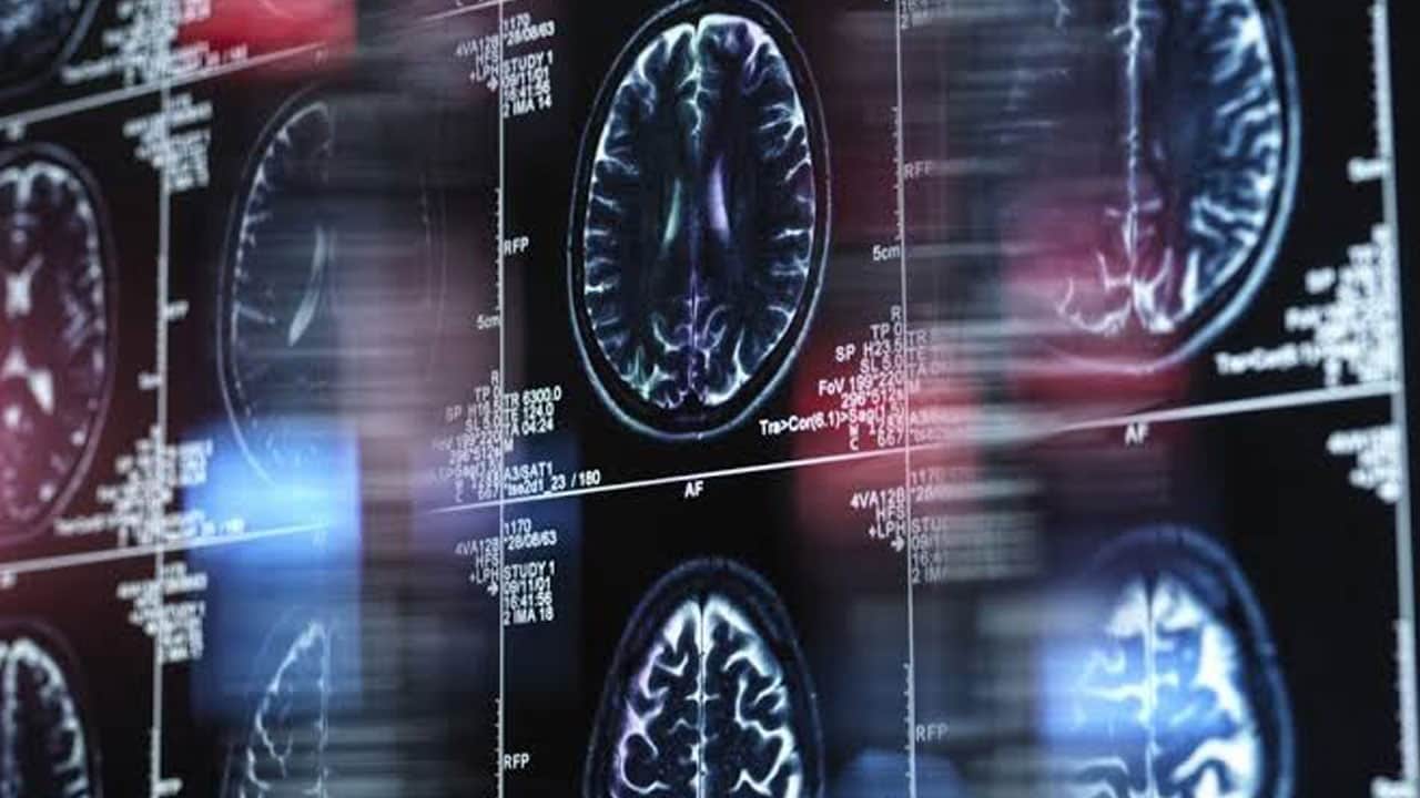 Foto - Fark edilmiyor sinsi ilerliyor! Alzheimer belirtisi uykuda mı başlıyor?