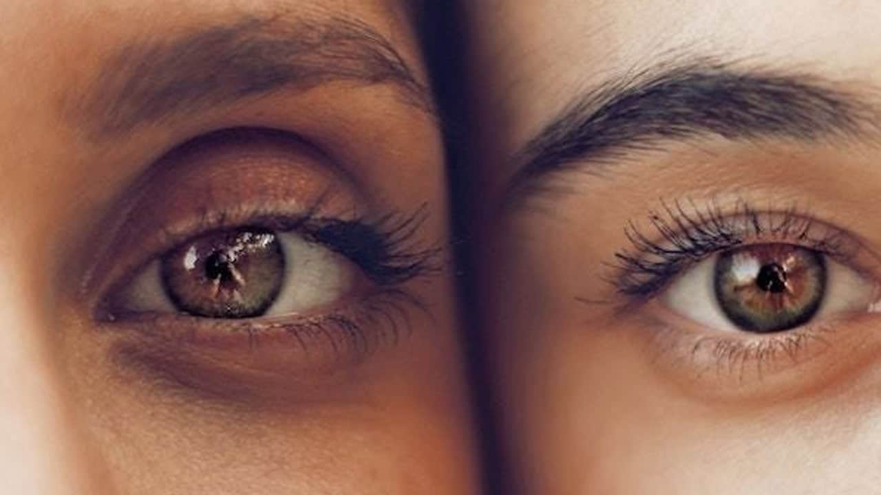 Foto - Fark edince hemen paniklemeyin! Göz altındaki değişimin nedeni bakın neymiş…
