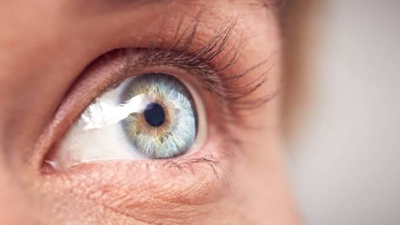 Foto - Fark edince hemen paniklemeyin! Göz altındaki değişimin nedeni bakın neymiş…