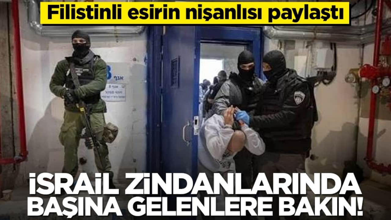 Filistinli esirin nişanlısı paylaştı: İsrail zindanlarında başına gelenlere bakın!
