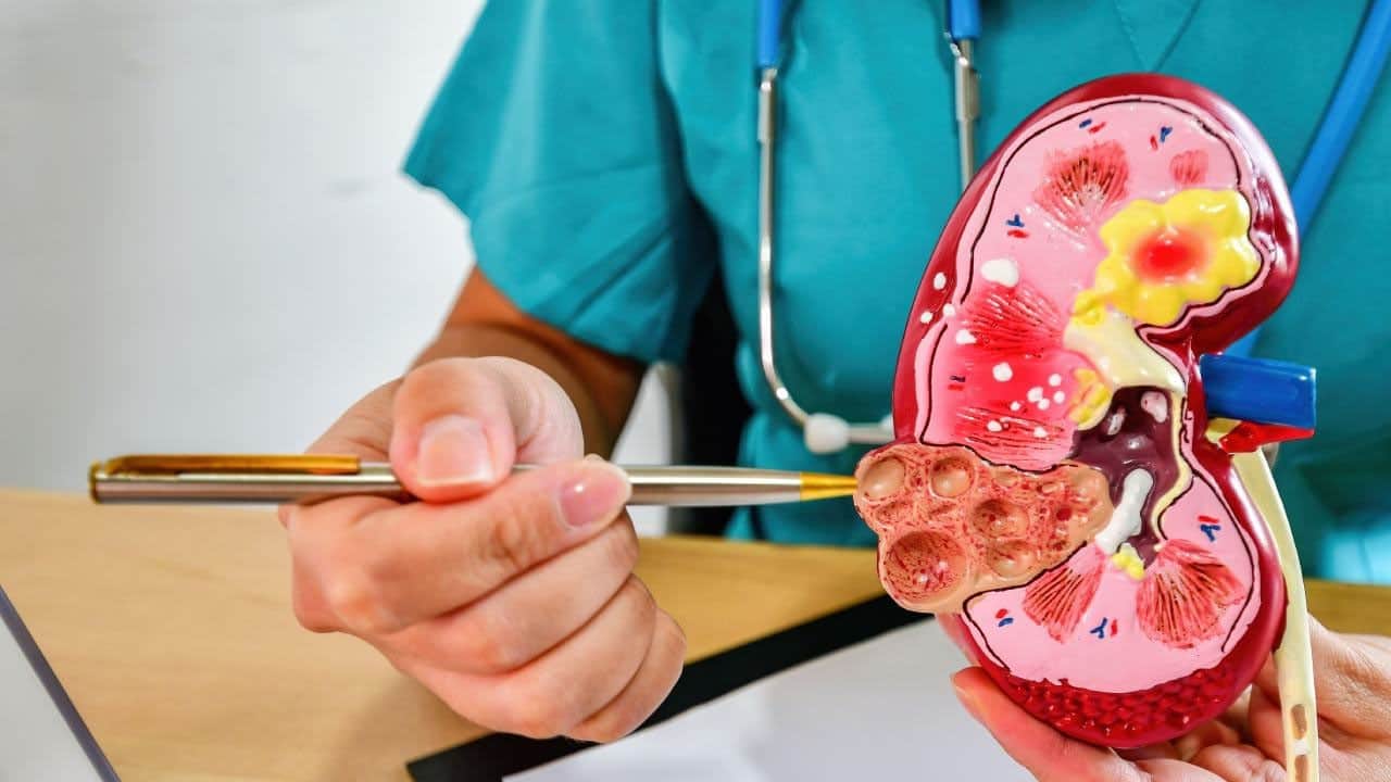 Foto - Günde bir avuç turna yemişi tüketin! Her derde deva... Faydası saymakla bitmiyor, kalbe iyi geliyor