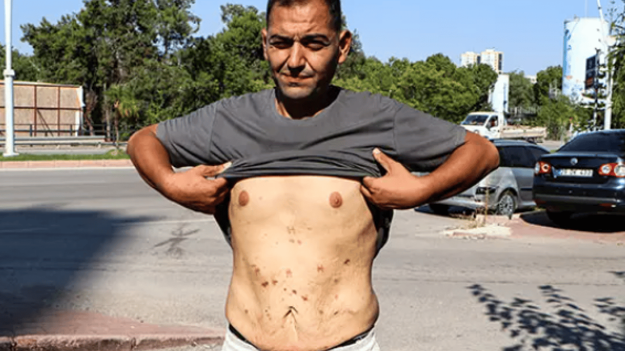 Foto - İki kez bıçak altına yattı: Kan kusmaya başladım diyerek yardım istedi!