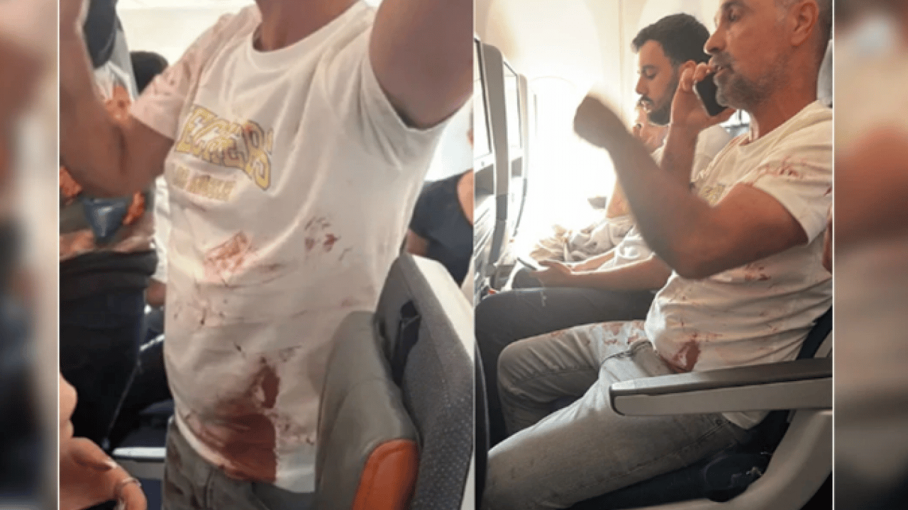 Foto - İsrail basınında ‘terör saldırısı’ iddiası: Kaptan pilot bıçaklandı uçak düşürülmek istendi