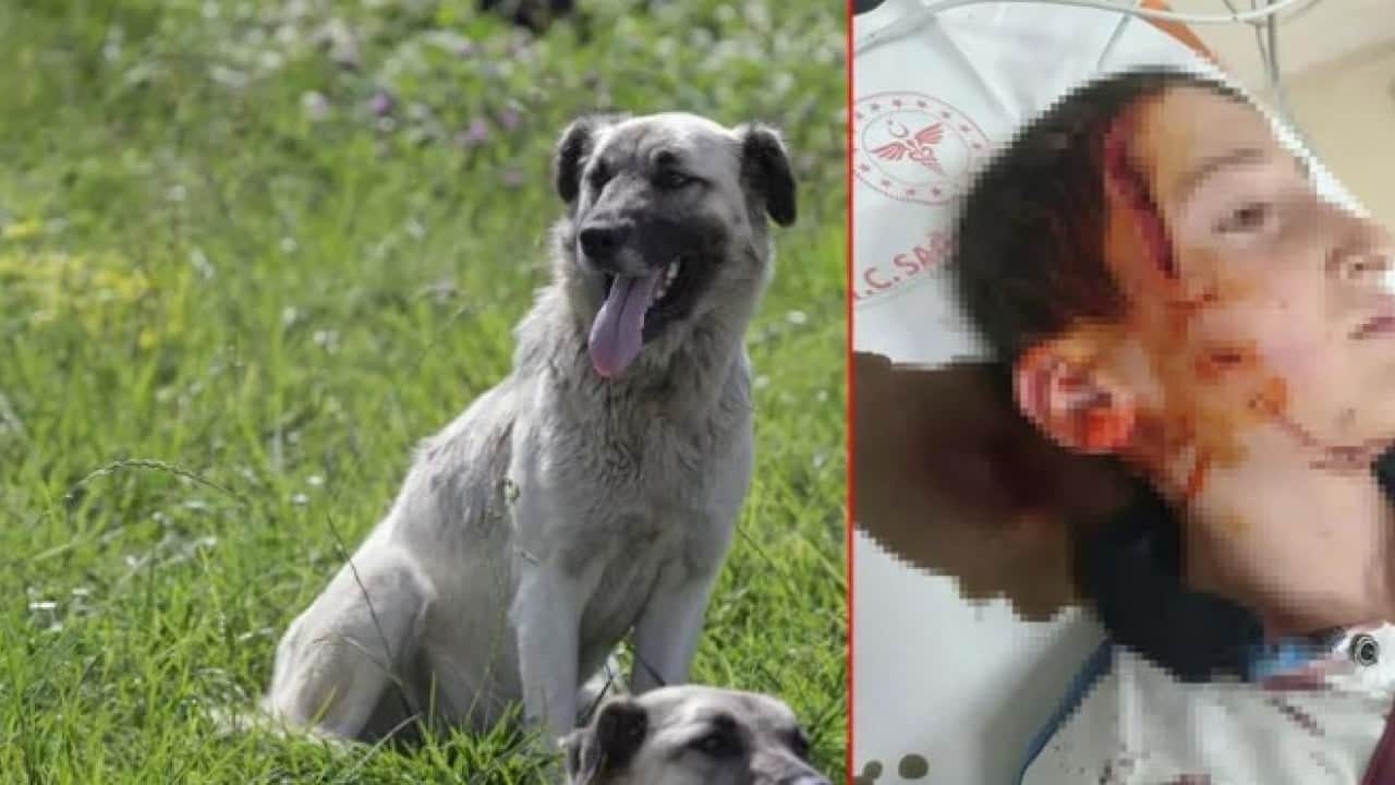 İzmir’de başıboş köpek 11 yaşındaki çocuğun yüzünü parçalamıştı! O davada karar açıklandı