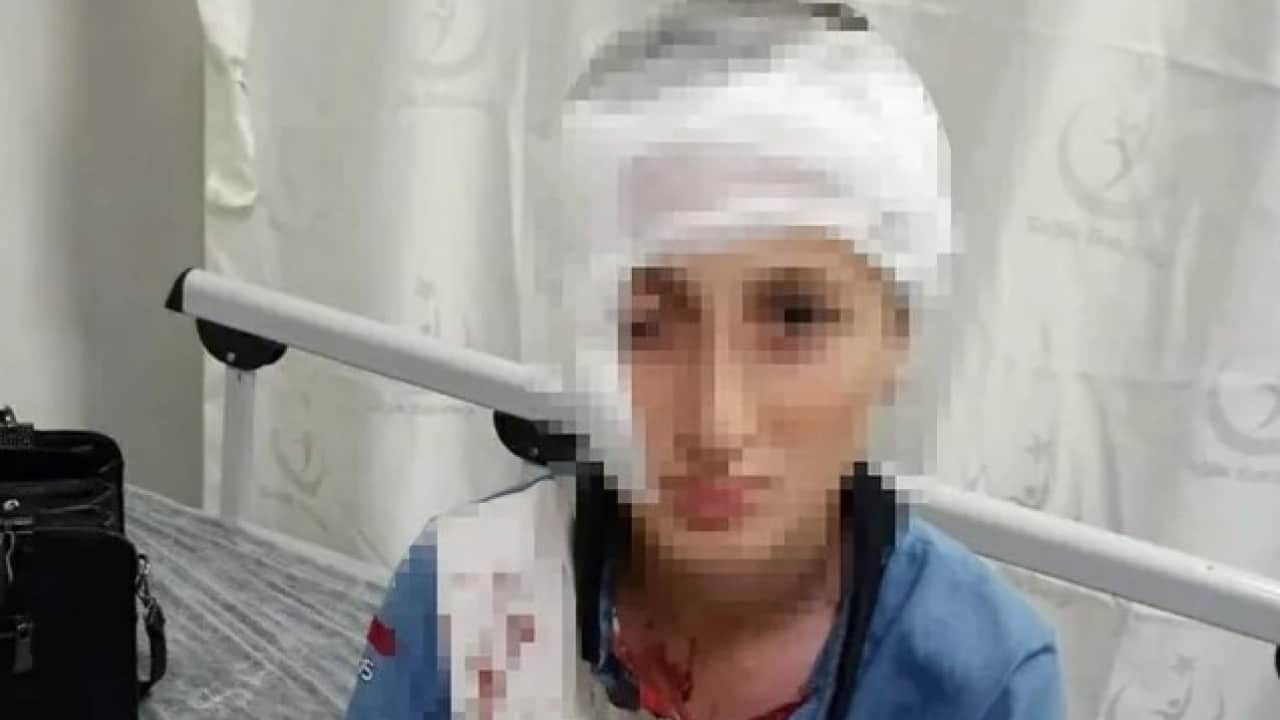 Foto - İzmir’de başıboş köpek 11 yaşındaki çocuğun yüzünü parçalamıştı! O davada karar açıklandı