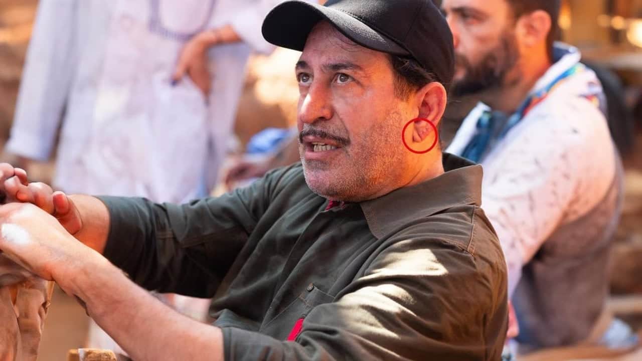 Kalp krizi geçiren Cem Yılmaz’daki gizli detay ortaya çıktı: "Frank işareti" alarmı verildi
