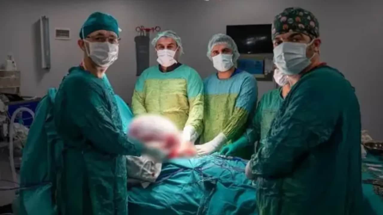 Karın ağrısıyla doktora gitti, gerçeği görünce şaşkına döndü! Tam 15 kilo çıkarıldı