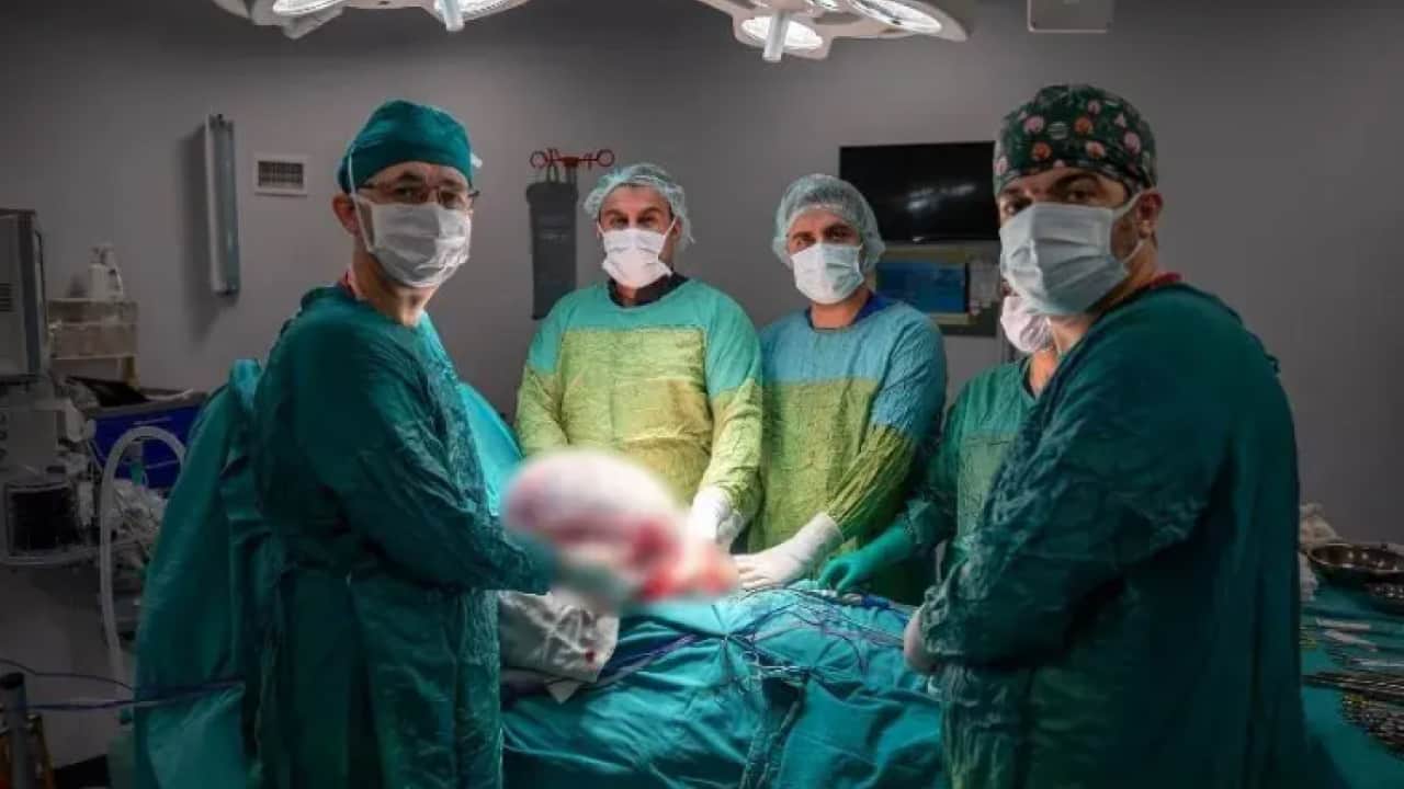 Foto - Karın ağrısıyla doktora gitti, gerçeği görünce şaşkına döndü! Tam 15 kilo çıkarıldı