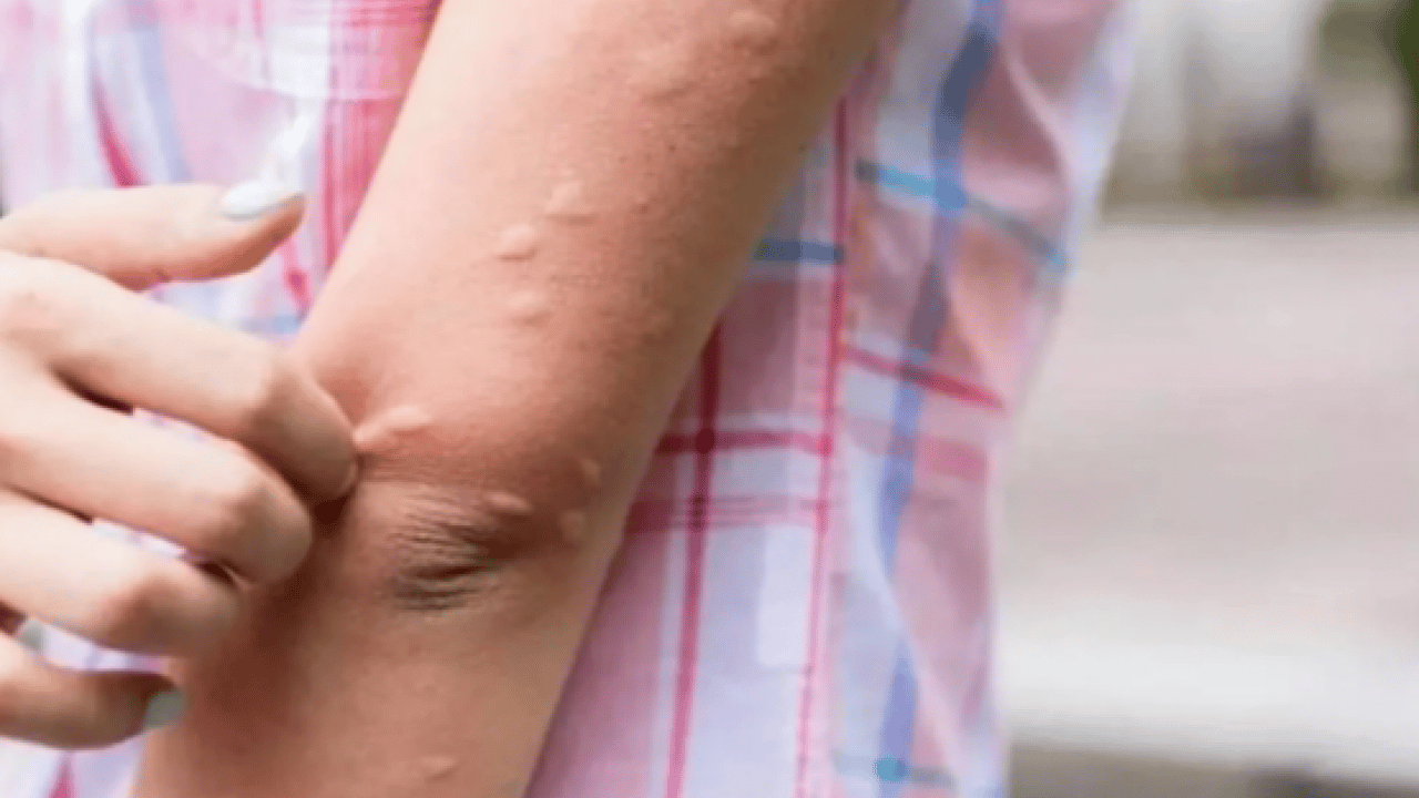 Foto - Komşuda virüs alarmı! Uzmanlardan kritik uyarı: Tehlike devam ediyor