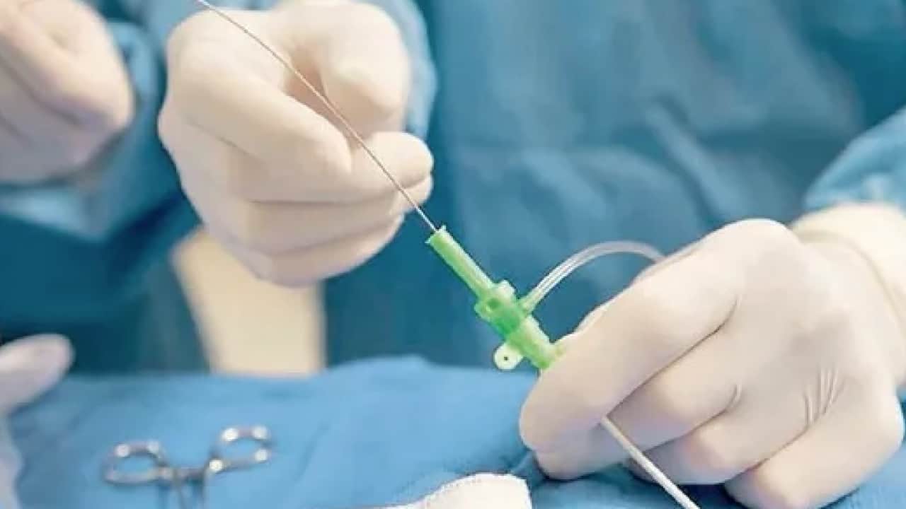 Foto - Kriyoablasyonla kanser donduruluyor ve... Karaciğer kanserinde kullanılan o yöntem!