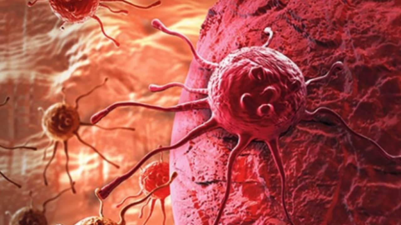 Foto - Ne işe yarıyor... Ölümcül tümörde yeni umut: Kanser hücreleri azalıyor! Savunma kalkanı çökertildi