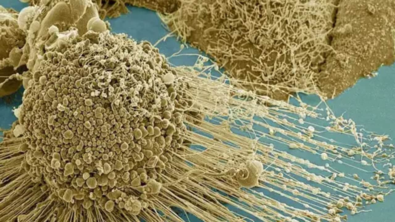 Foto - Ne işe yarıyor... Ölümcül tümörde yeni umut: Kanser hücreleri azalıyor! Savunma kalkanı çökertildi